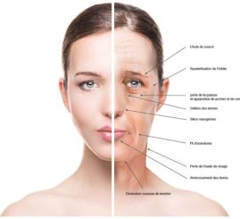 Conséquences de la ménopause sur le visage, Dessèchement Rides